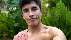 Marc Marquez Ungkap Kondisi Cedera Usai Insiden MotoGP Mandalika 2025