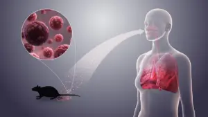 IDAI: Hantavirus Bukan Virus Baru, Masyarakat Diminta Cegah dengan PHBS